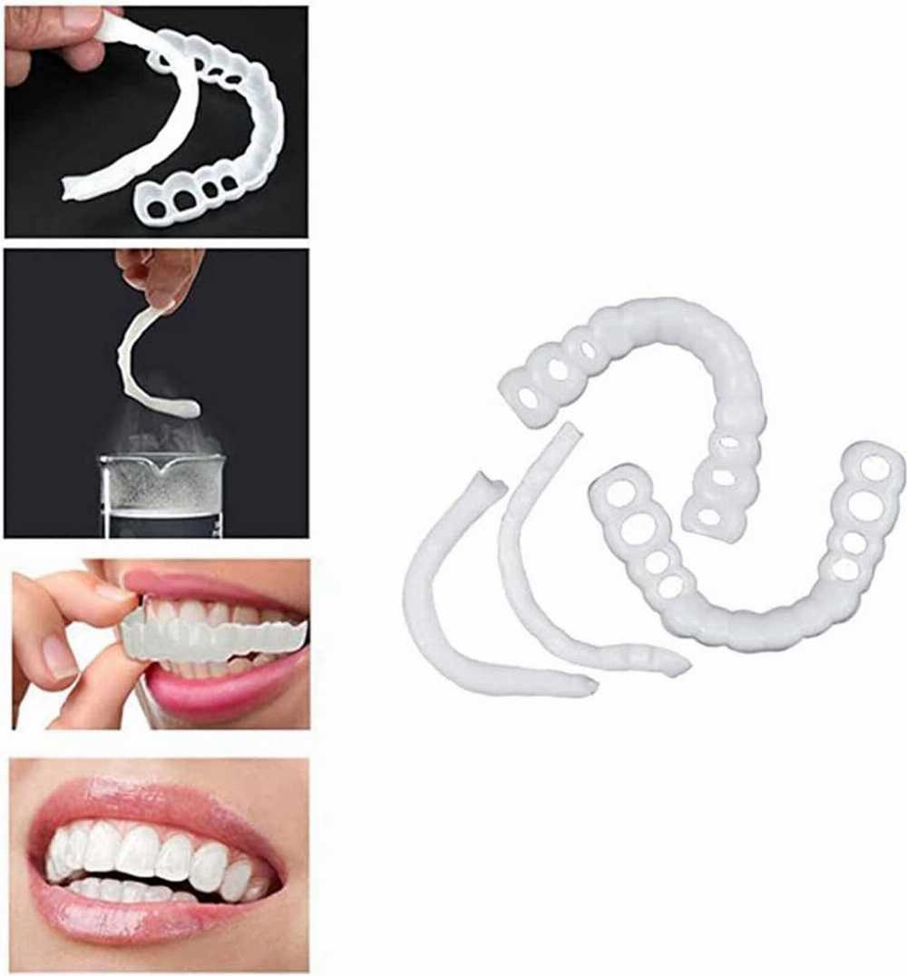 Snap On Smile - Snap On Smile