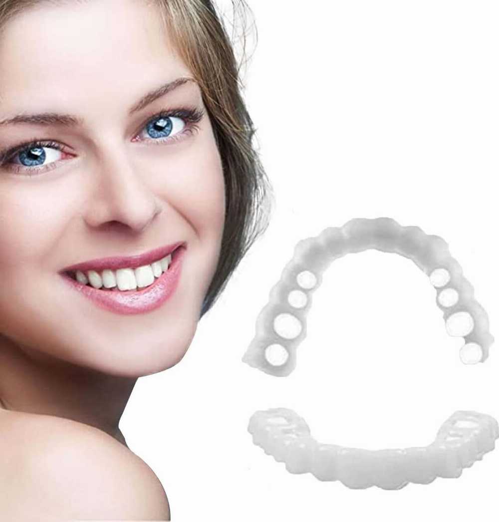 Snap On Smile - Snap On Smile