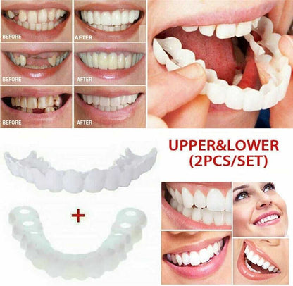 Snap On Smile - Snap On Smile