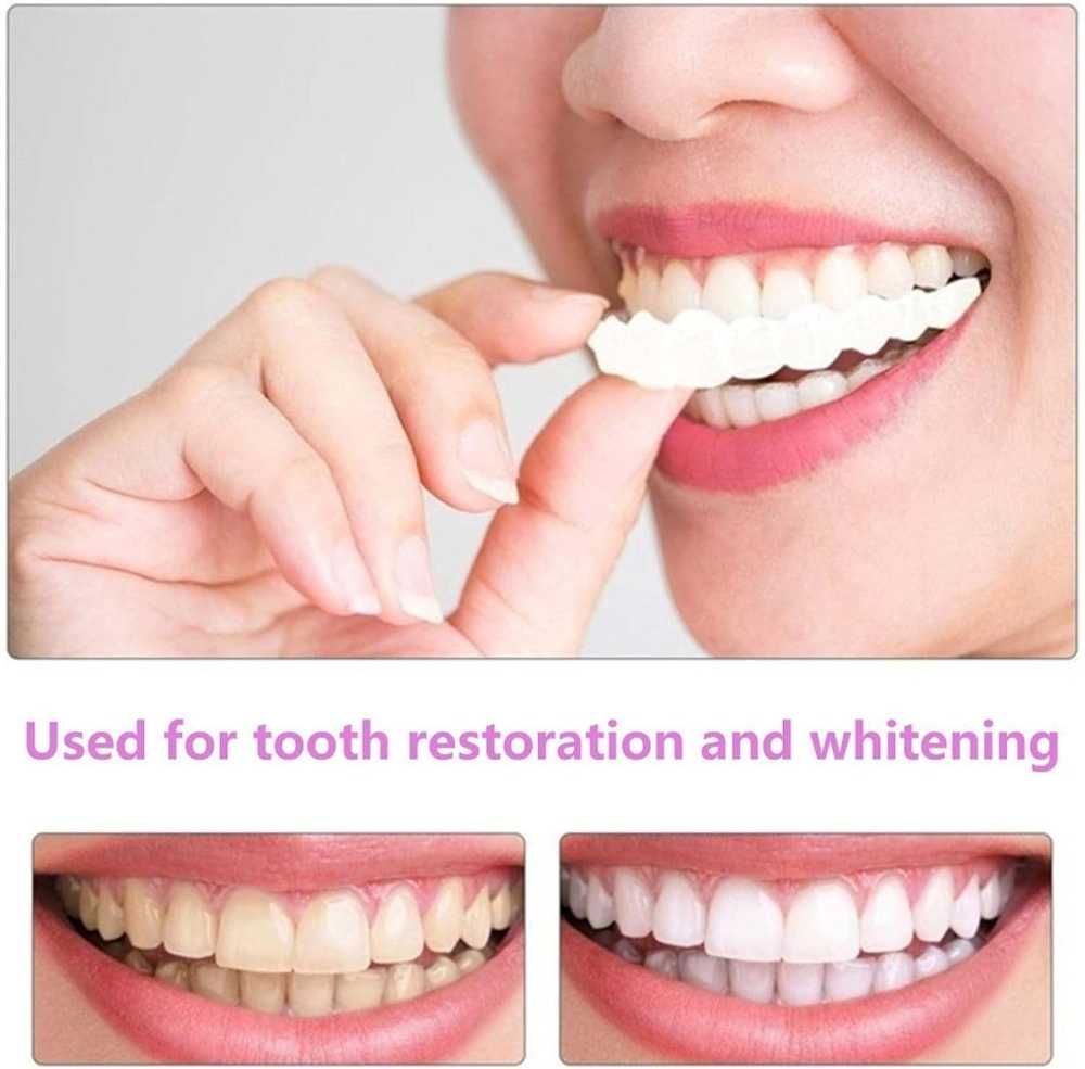Snap On Smile - Snap On Smile